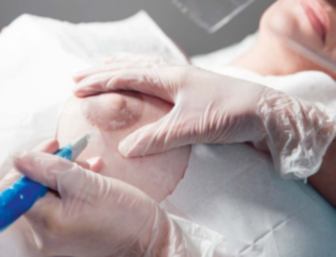 SIEBEN DOLCHE - Paramedizinische Pigmentierung